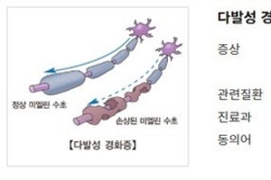 [이런 병, 저런 병] <26>대표적 자가면역 질환, 다발성경화증