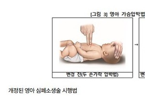 여성, 심정지 때 속옷 안 벗긴 채 심폐소생술한다
