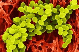 모든 감기·독감 예방하는 ‘보편 백신’ 나오나?