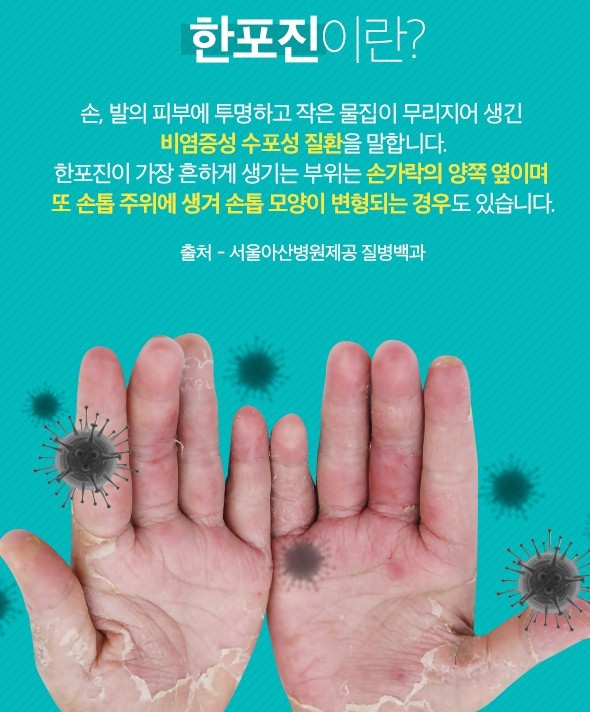 (서울아산병원)