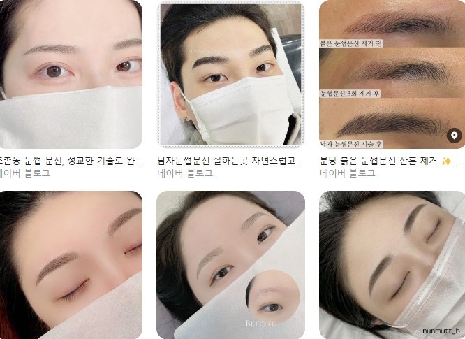 포털에 올라와있는 눈썹 문신 광고 이미지들. /네이버