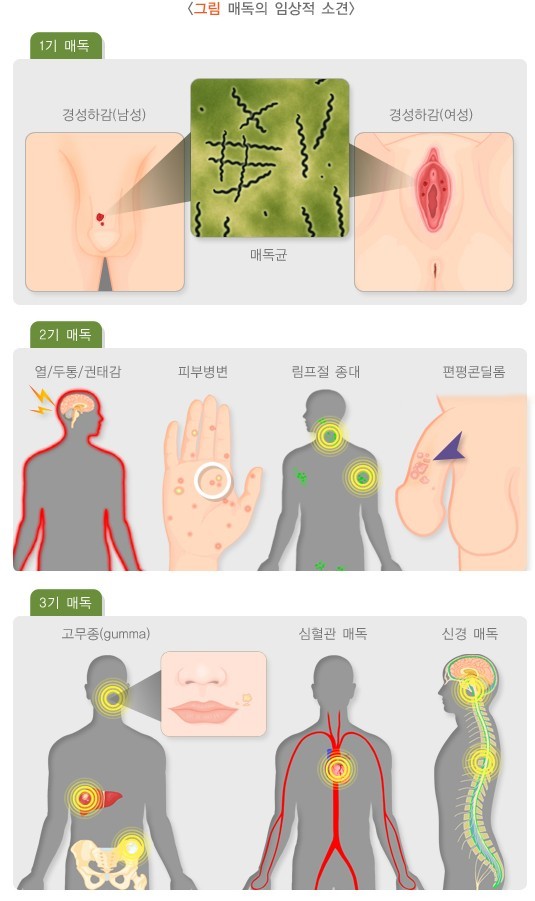 국가건강정보포털