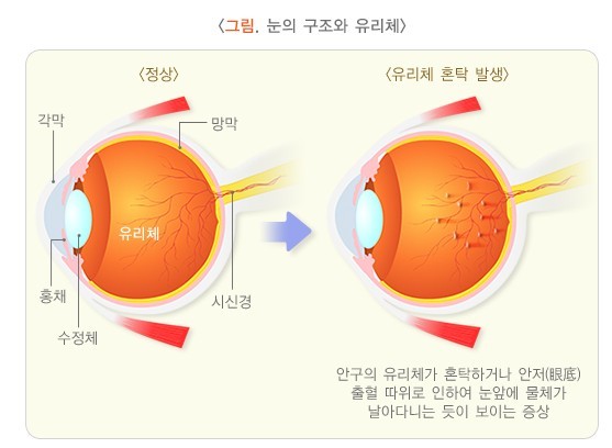 국가건강정보포털