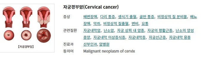 서울아산병원 질환백과.