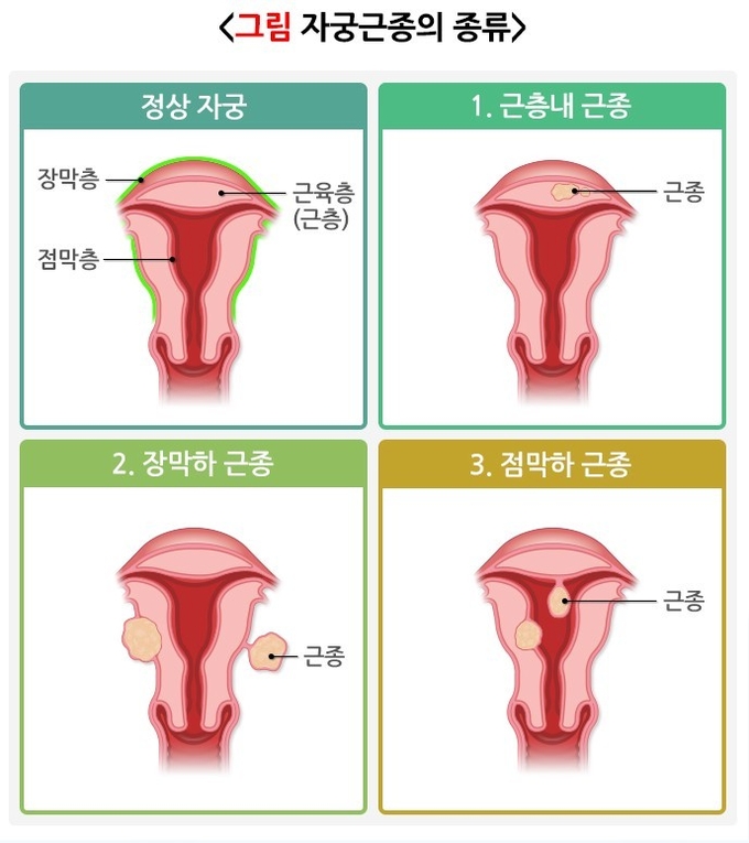 국가건강정보포털<br>