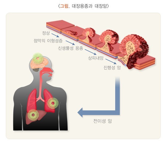 국가건강정보포털