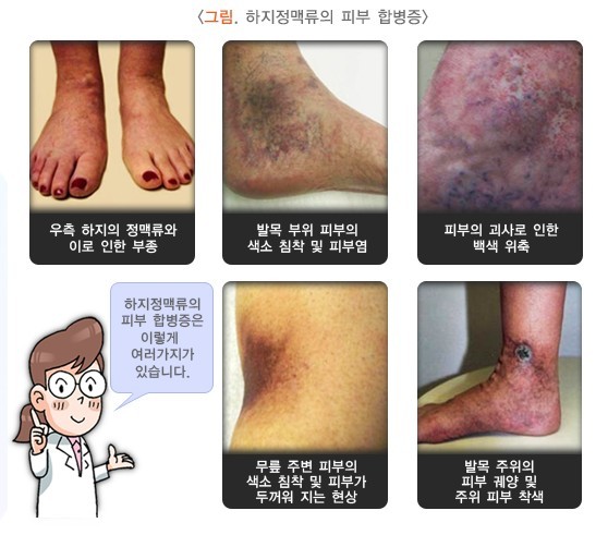 국가건강정보포털