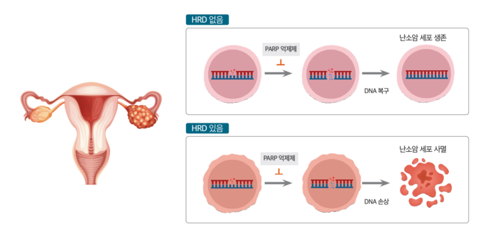 난소암은 조기발견이 어려운 질환이다. 최근 난소암 발병률이 매년 평균 2.3% 증가하고 있어 더 주의가 필요하다. 사진 | 더행복한건강생활