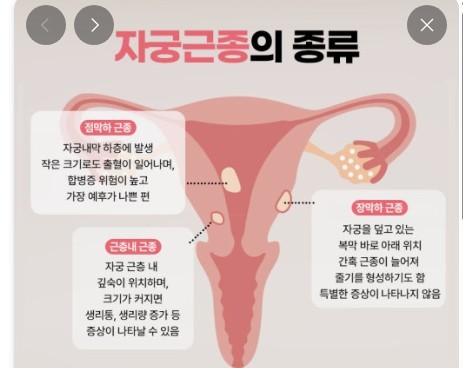 네이버 블로그