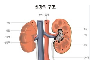 [이런 병, 저런 병] <39>감기로 오인하기 쉬운 신우신염