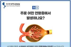 [이런 병, 저런 병] <40>만성신부전으로 악화할 수 있는 사구체신염