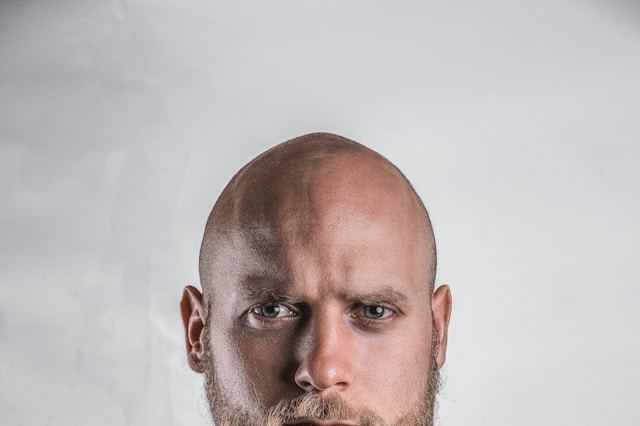 [궁금한 건강] <69> 대머리치료제 먹으면 성기능 장애?