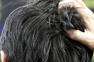 [궁금한 건강] <71>흰머리 뽑으면 더 많이 난다고?