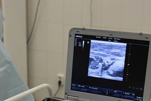 생존율이 가장 낮은 췌장암이 보내는 신호는?