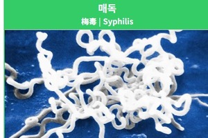 [Love&Sex] <35>성관계 후 온몸에 발진이 나타나면