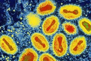 [질병의 역사와 의학] <9>인류, 거대한 죽음의 사슬을 끊다-천연두 종식