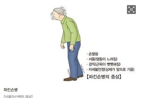 고령 부모님 걸음 늦고 손떨림...파킨슨병 의심해야